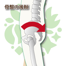骨盤の後傾イメージ図