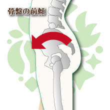 骨盤の前傾イメージ図