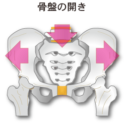 骨盤の開きイメージ図